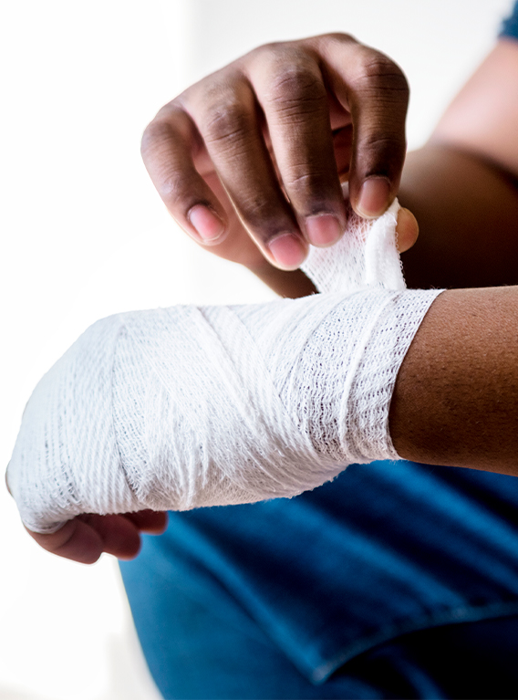 workplace hand injury