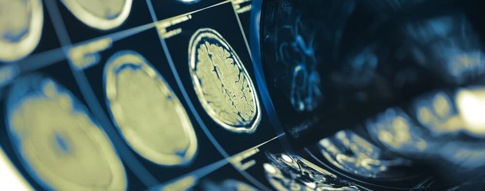 doctor looking over a scan of a person who received trauma to the head seen in the xray