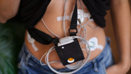 Woman wears defective medical device for daily ECG monitoring